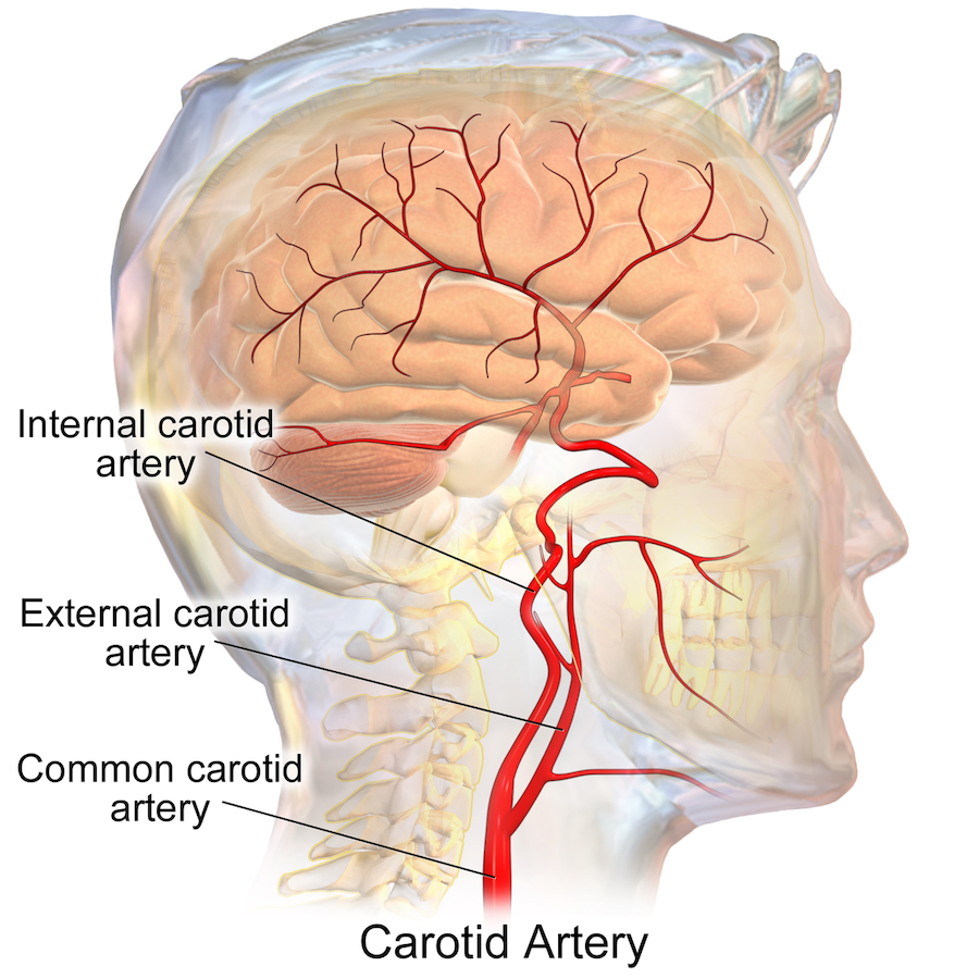 CarotidArteries