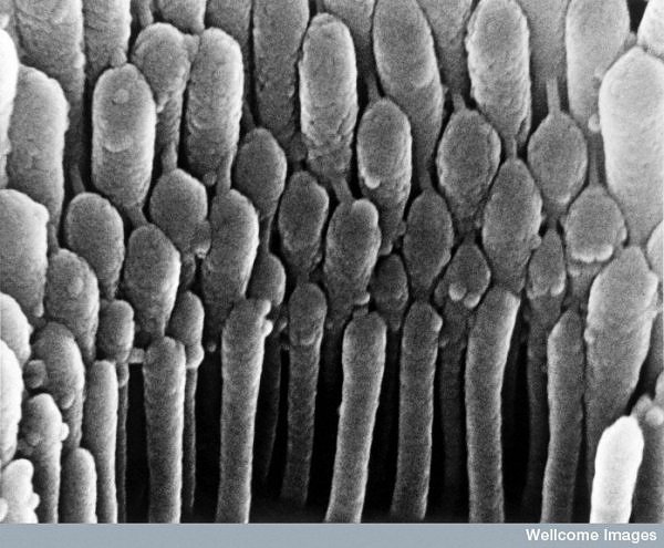 Hair Cell in the Ear 